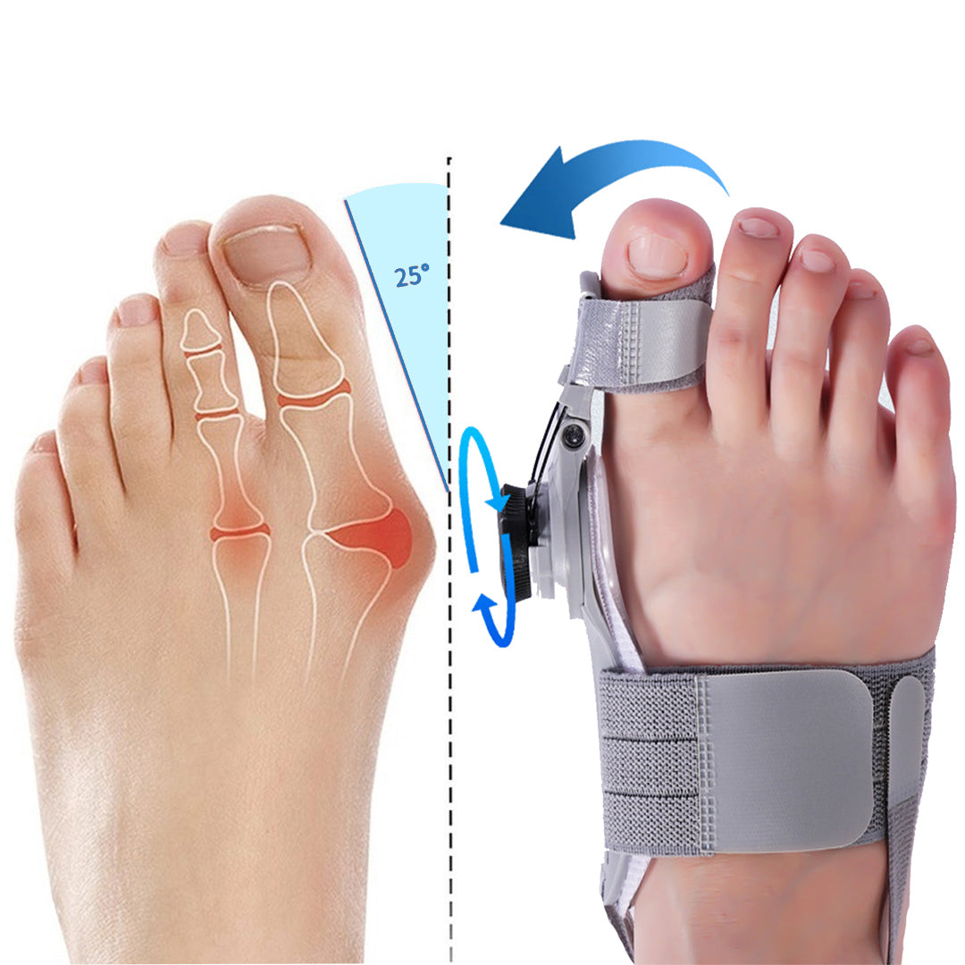 Bunion Align - Natural At-Home Bunion Relief